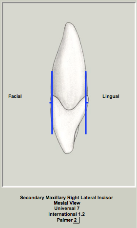 Extent CofC Mx Lateral.png